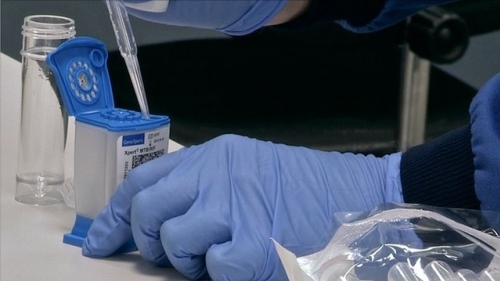 SUS vai oferecer teste rápido para tuberculose